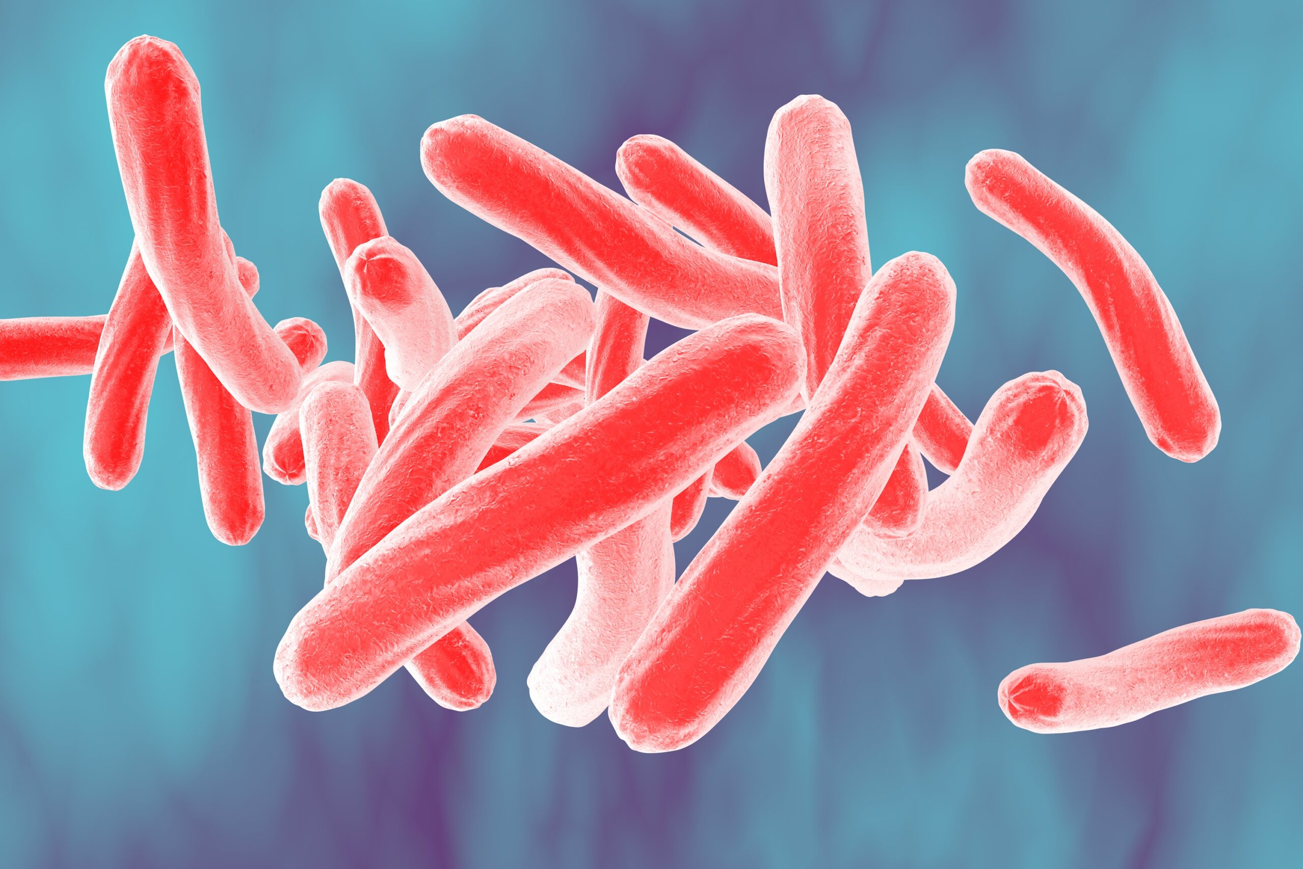 Disease Review: Tuberculosis